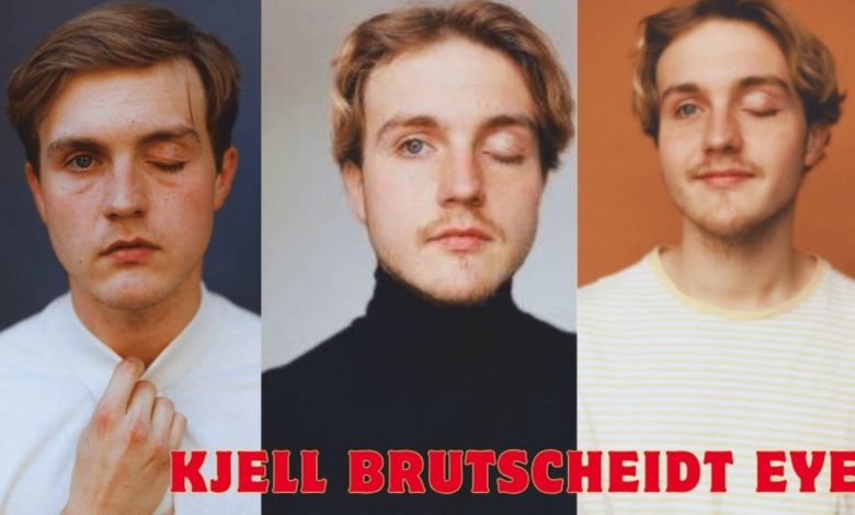 Kjell Brutscheidt eye