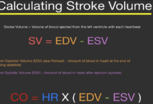 stroke volume equation