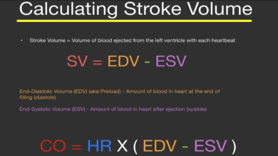 stroke volume equation